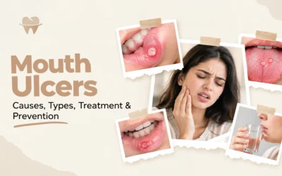 Everything You Need to Know Before Laser Hair Removal in Lahore